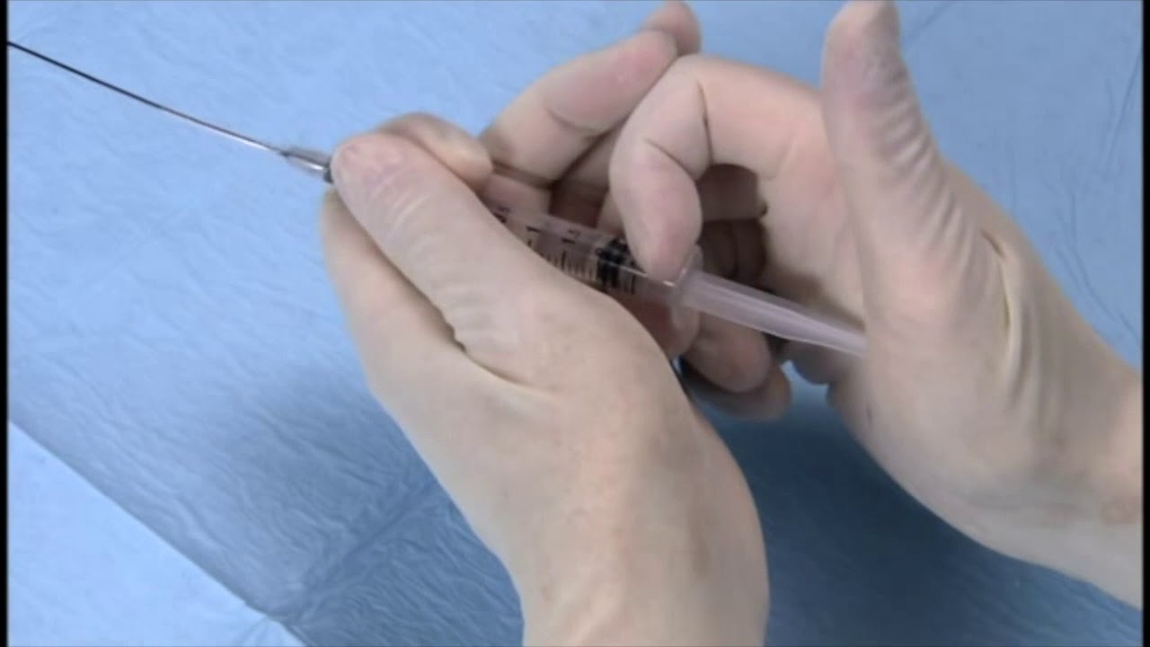 Angioplasty technique: Nanto's technique (+English subtitle)
