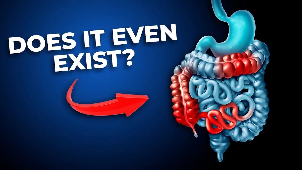 Why IBS is One of the Most Misdiagnosed Conditions