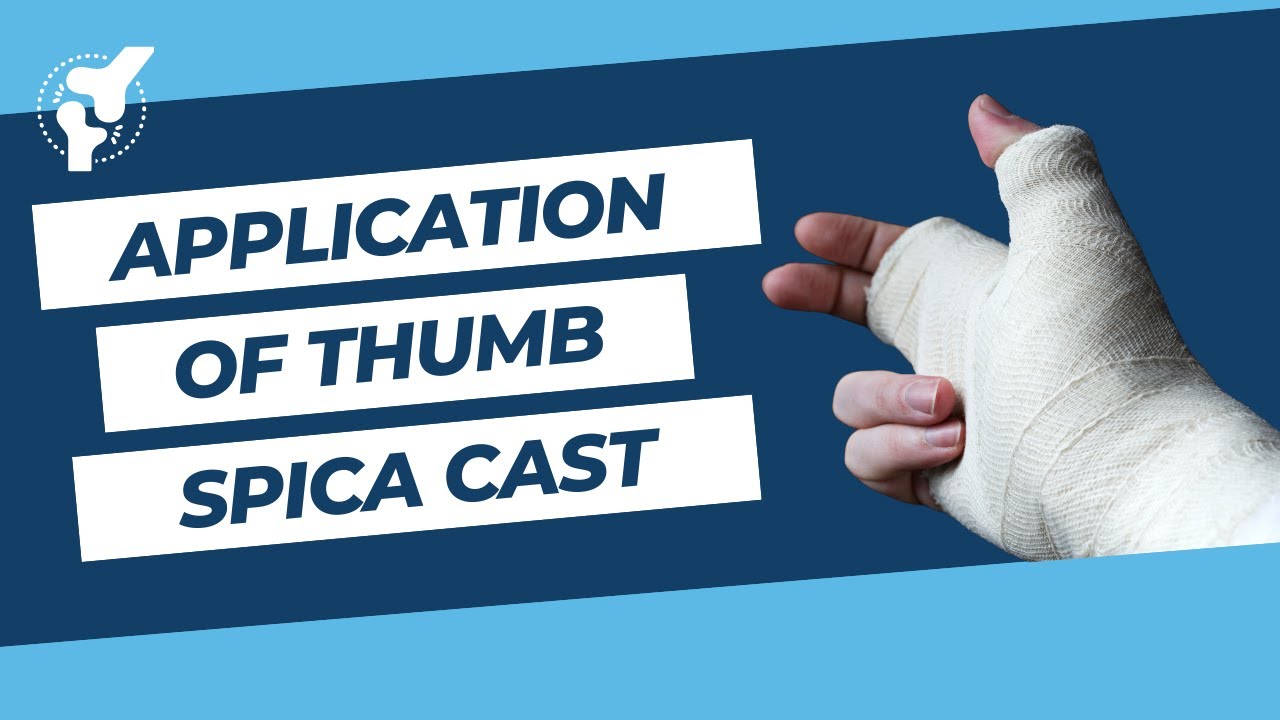 Thumb Spica Cast | Demonstration of the Application of Fibreglass Cast | Orthopaedic Academy