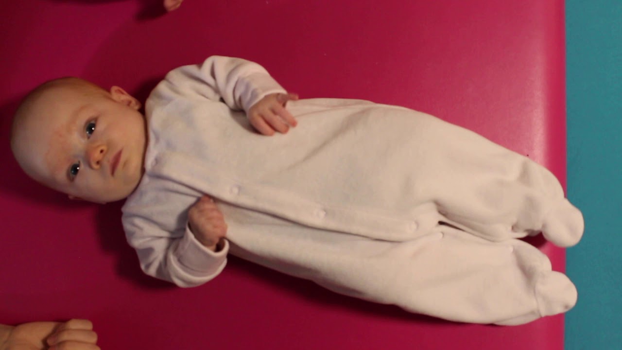 Infantile Postural Asymmetry & active rotation part 1