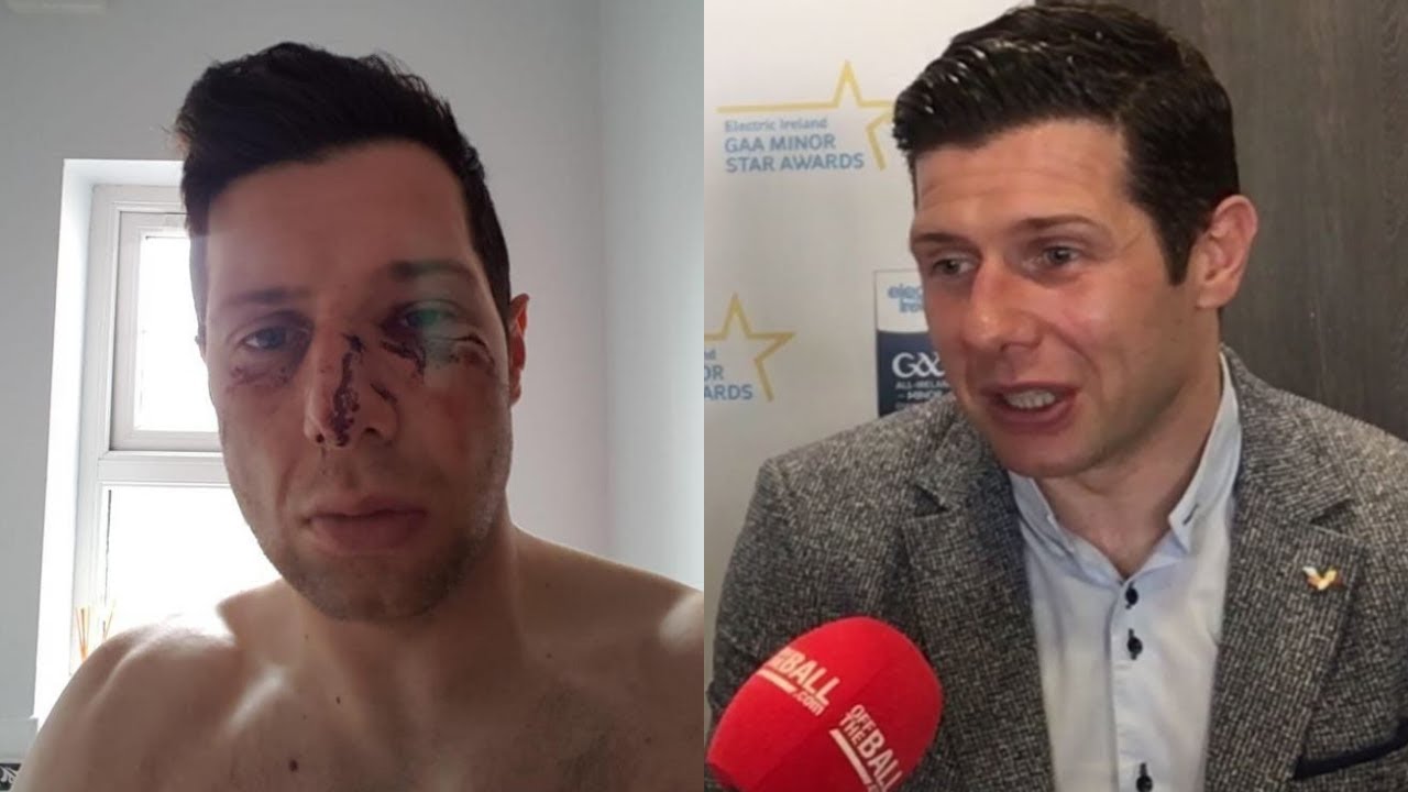 Sean Cavanagh on horror injury: 