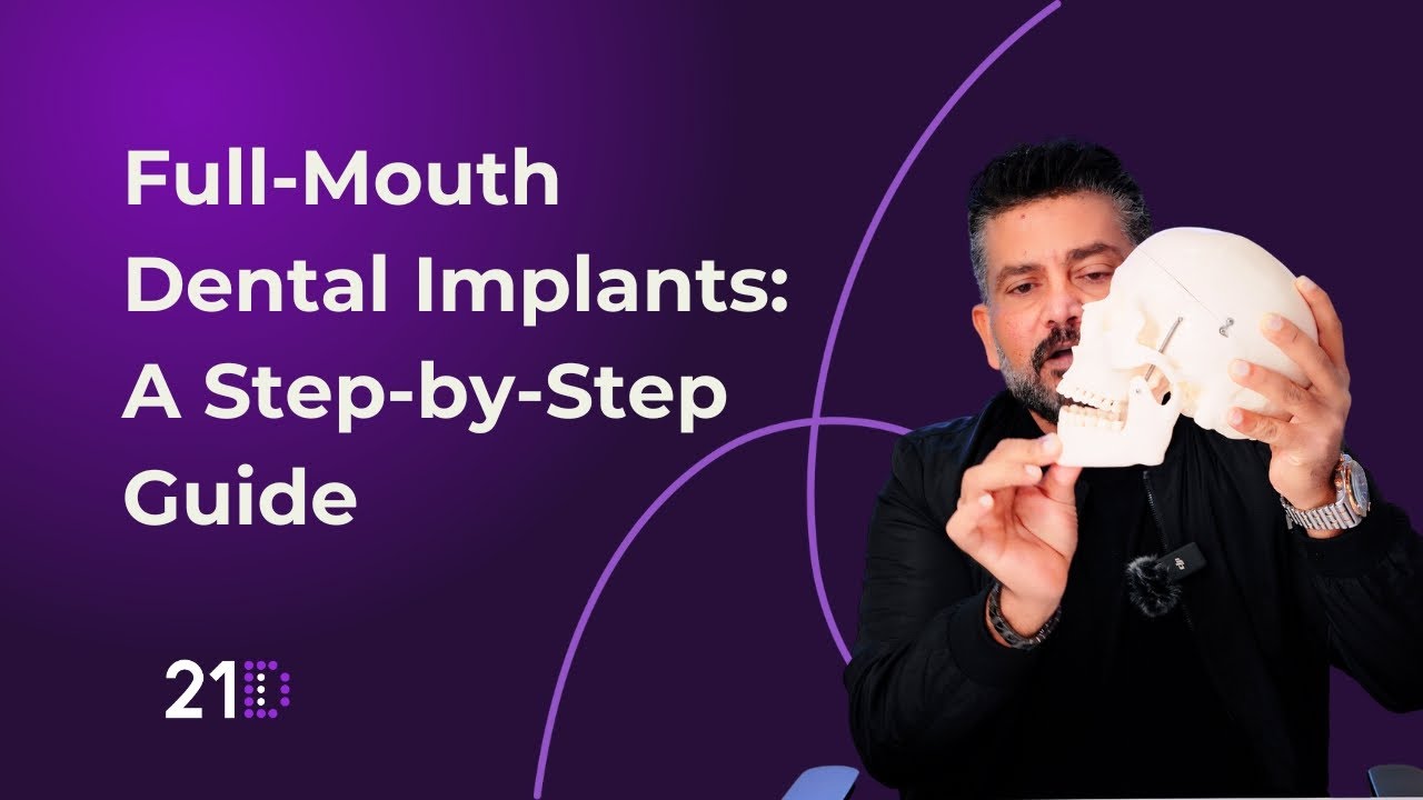 Full-Mouth Dental Implants: Step-by-Step Guide Procedure at 21D