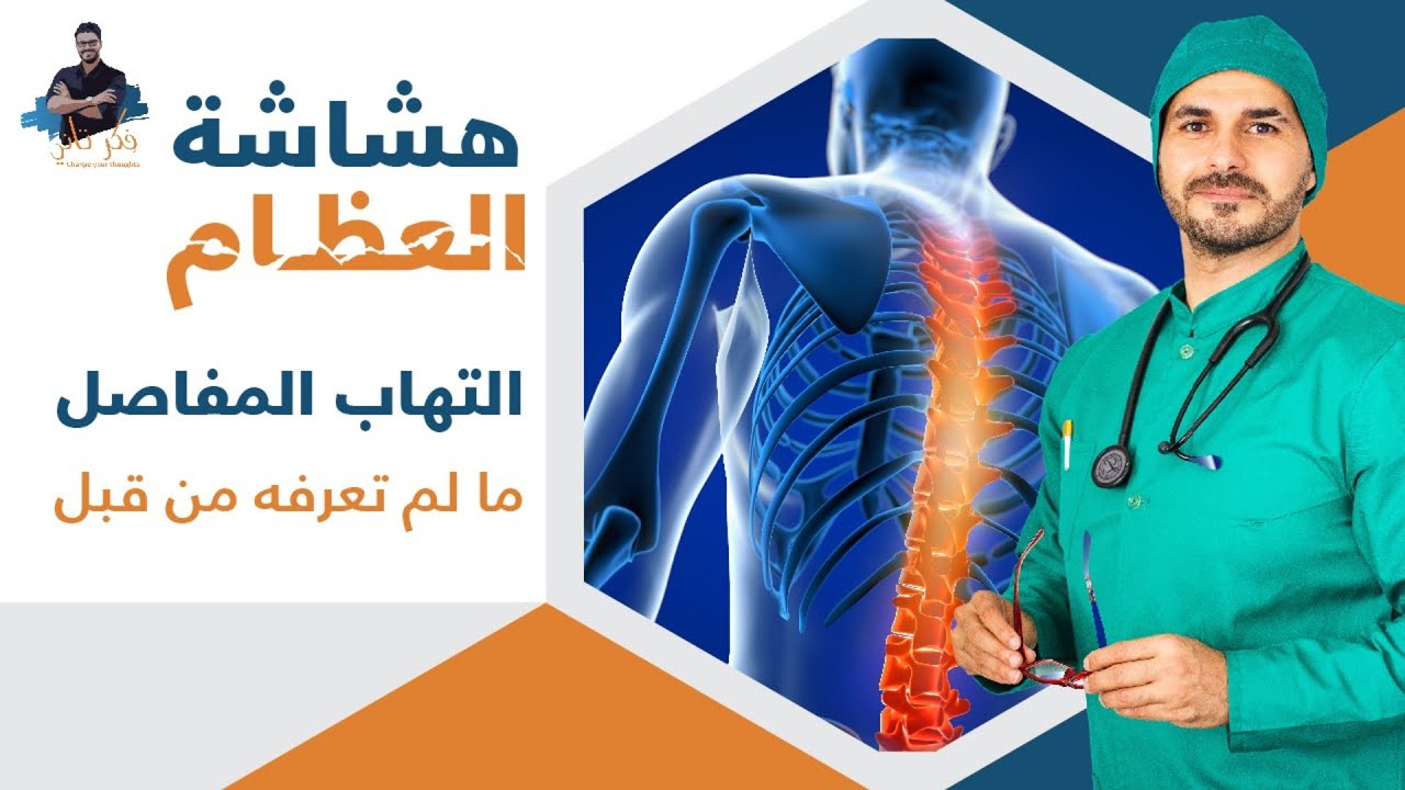 علاج هشاشة العظام والتهاب المفاصل الفعال _تاكل الغضاريف _ كلام لم تسمعه من قبل