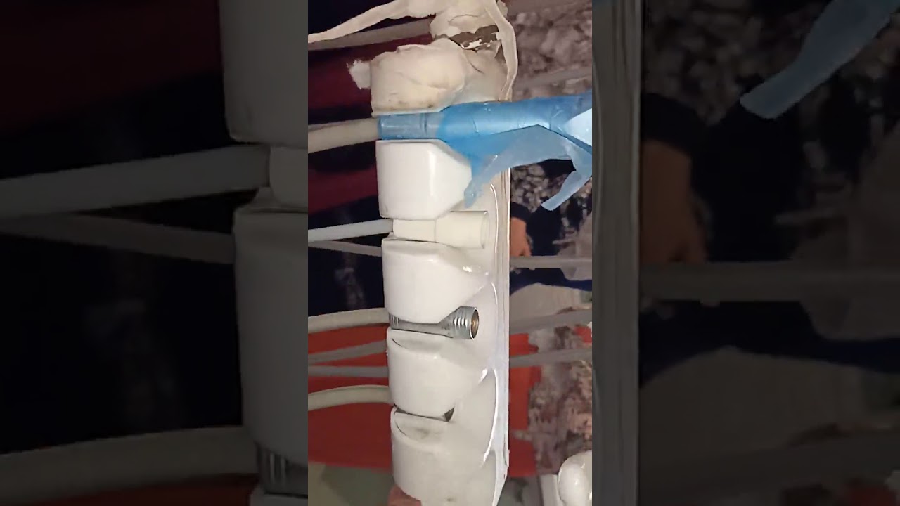 شرح وصلات كرسى الأسنان