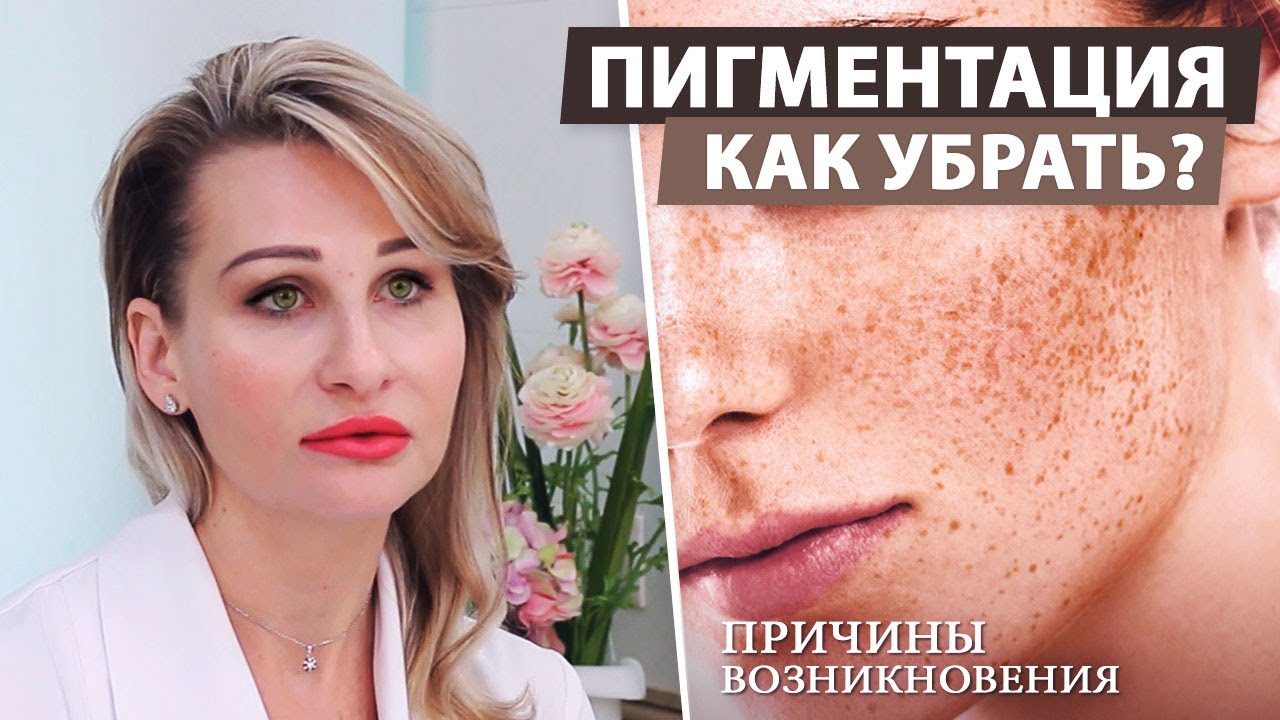Что можно сделать чтобы убрать пигментные пятна на лице