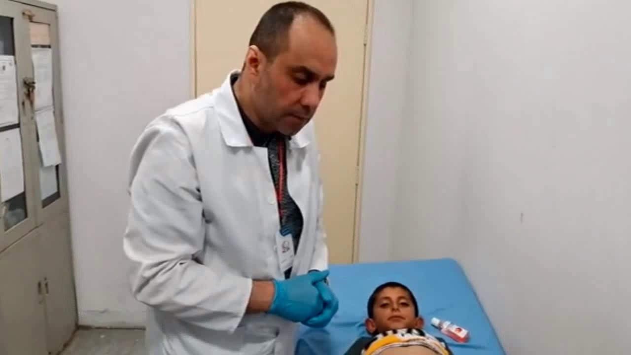 Ascites Examination -  Dr Ali Adel - Rapid Video