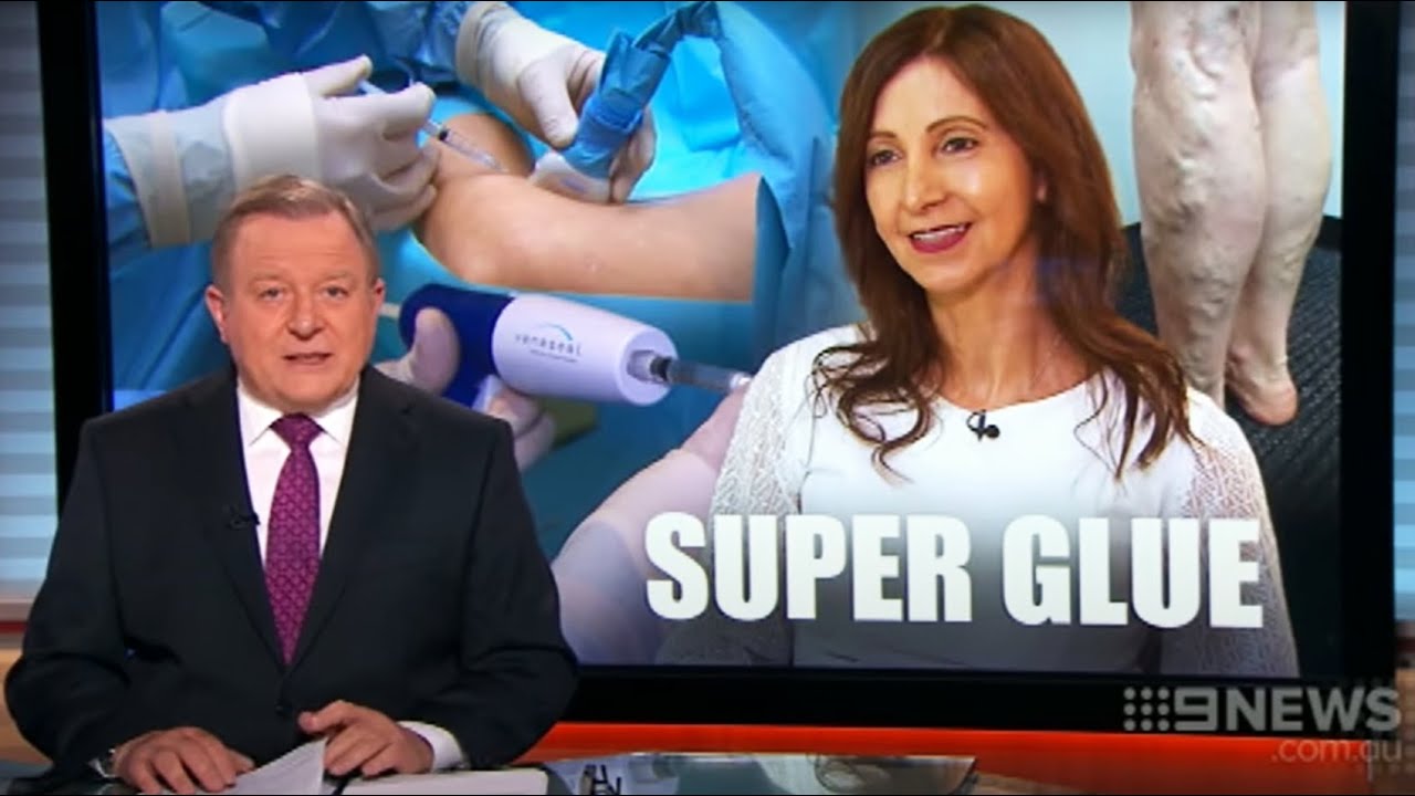 VenaSeal Vein Glue Treatment at Vein Health Medical Clinic, Melbourne and Sydney