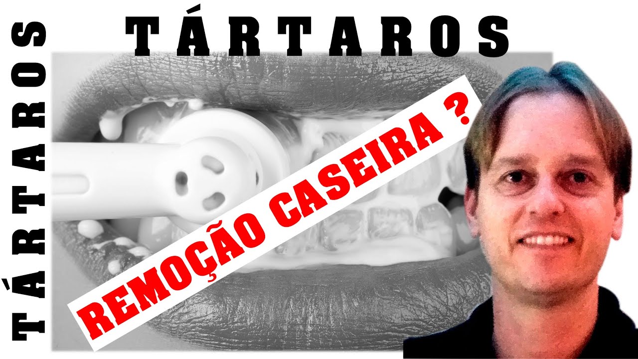 Programa Viver Sem Tártaros e Kit de Visualização de Boca, Dentes e Gengivas