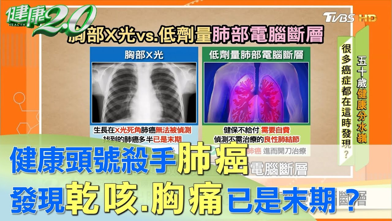 健康頭號殺手肺癌 發現乾咳.胸痛已是末期？ 健康2.0