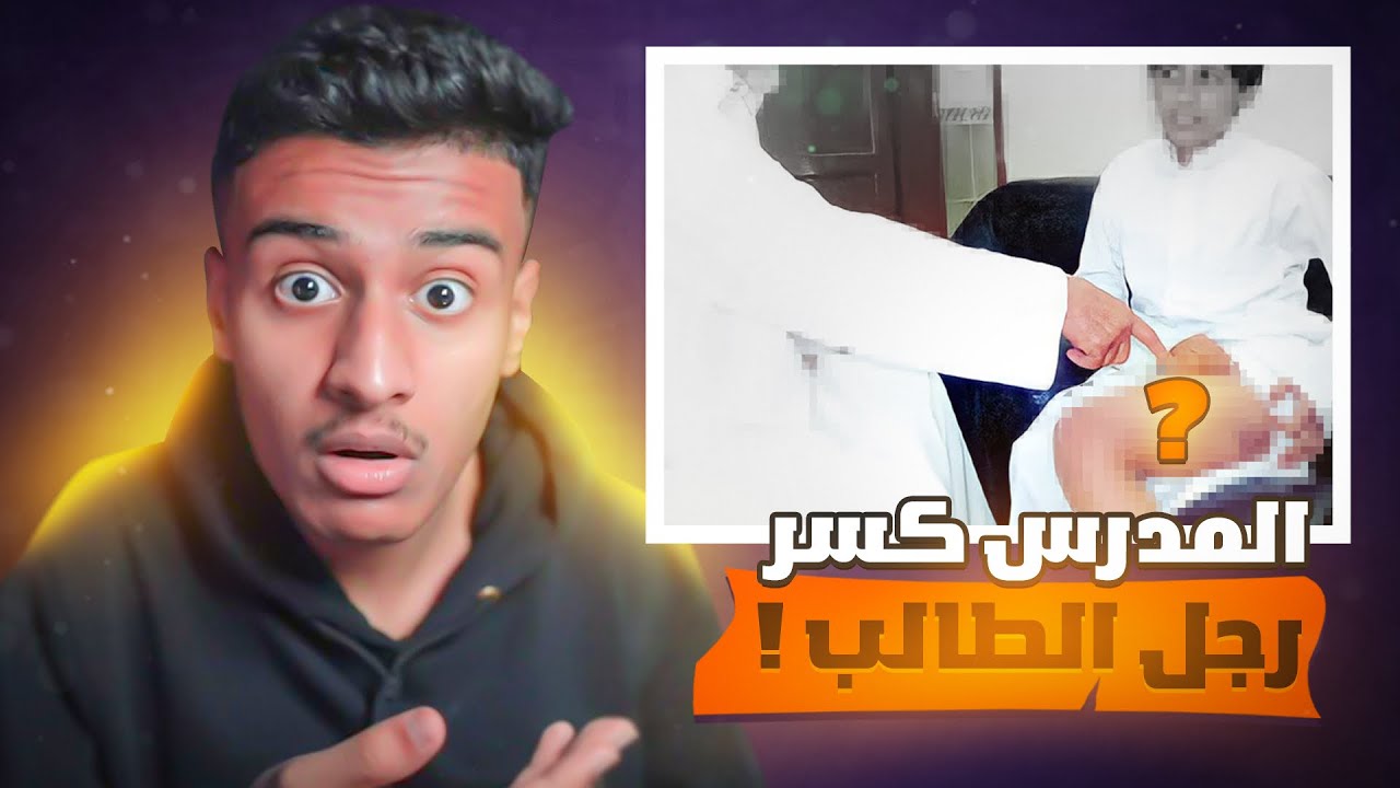 قصة المدرس الي كسر رجل الطالب ( وكان بيكسر رجلي 😨 ) قصص ايام الدراسة !!