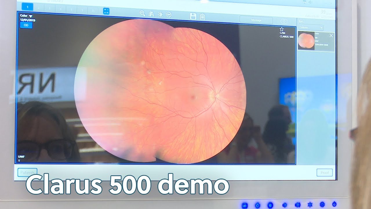 Zeiss speaks to OT about its Clarus 500 camera