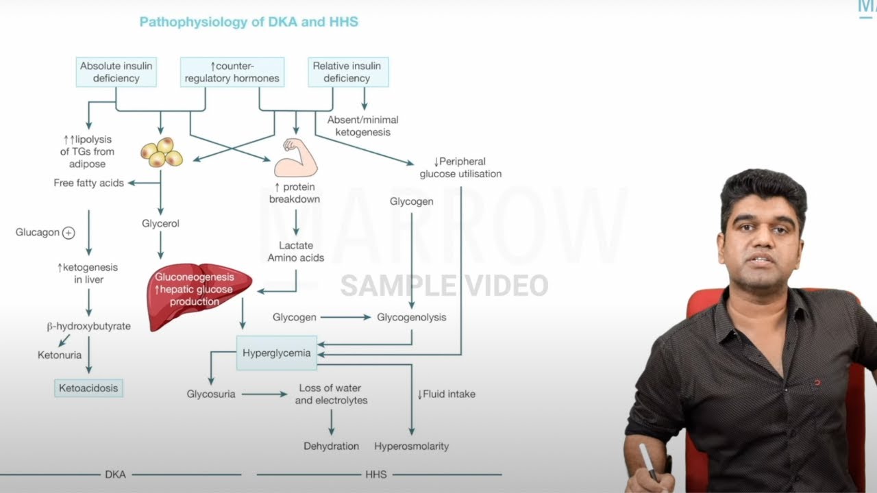 E6 Sample Video: Diabetic Ketoacidosis (Medicine)