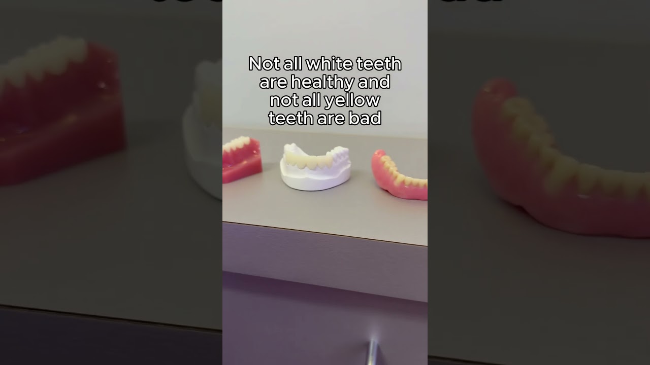 Not all white teeth are healthy and not all yellow teeth are bad