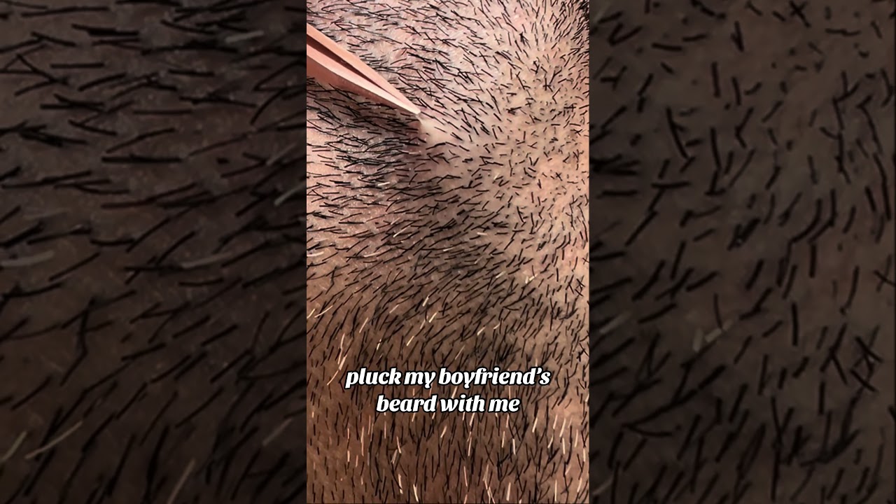 plucking thick beard hairs 🫶🏼 #beard #plucking #satisfyingvideo #satisfying #tweezing #asmrvideo