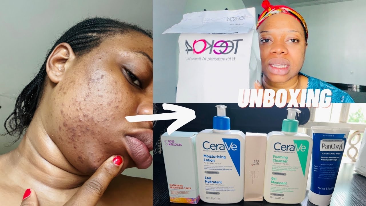 My FACE is Getting Worse| UNBOXING Skincare Products| Cerave Foaming Facial Cleanser.