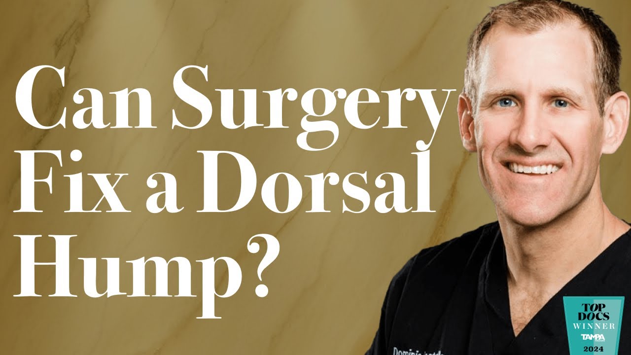 Can Facial Plastic Surgery Fix a Dorsal Hump?