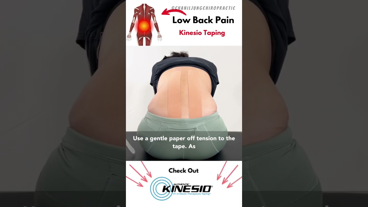 Kinesio Taping: Low back pain