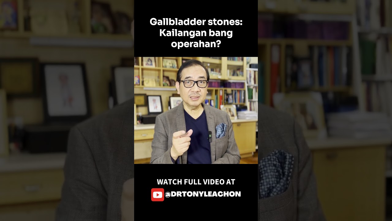 Gallbladder stones: Kailangan bang operahan? #DrTonyLeachon #medtalks