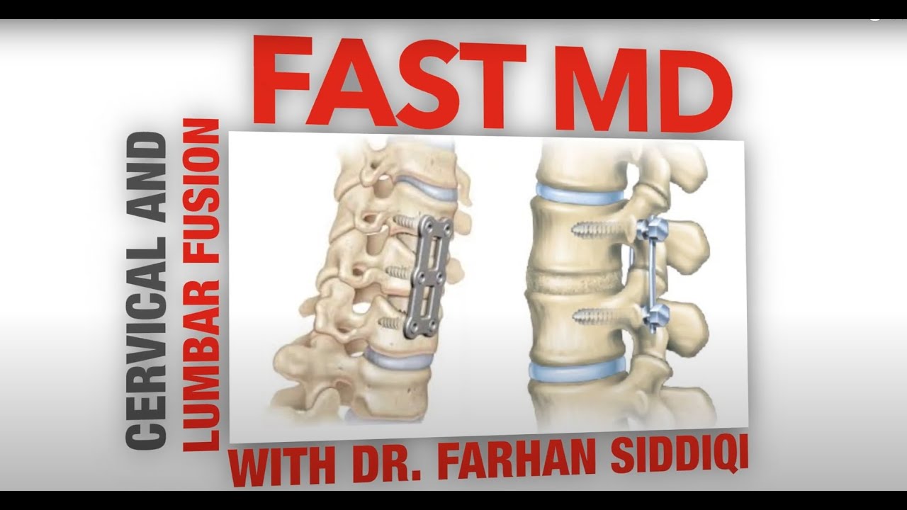 DR  SIDDIQI FUSION VIDEO FAST MD