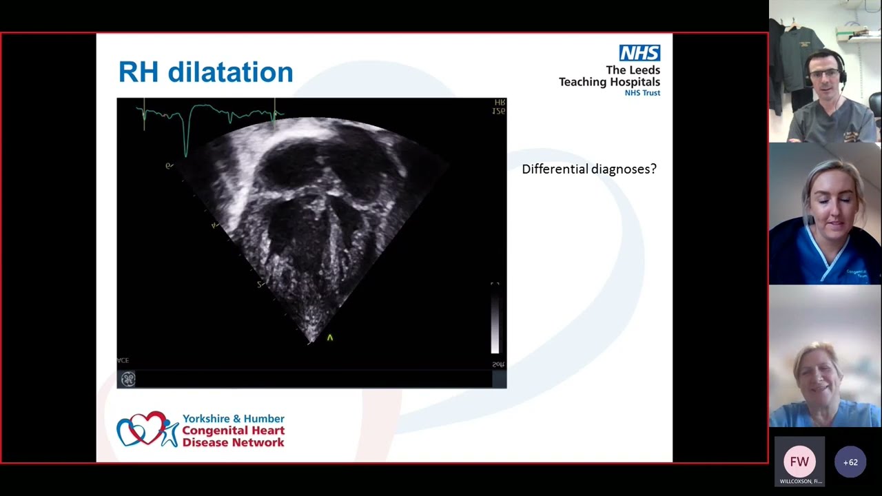 Coarctation & Interrupted Aortic Arch - Dr Fiona Willcoxson & Hannah Shaw