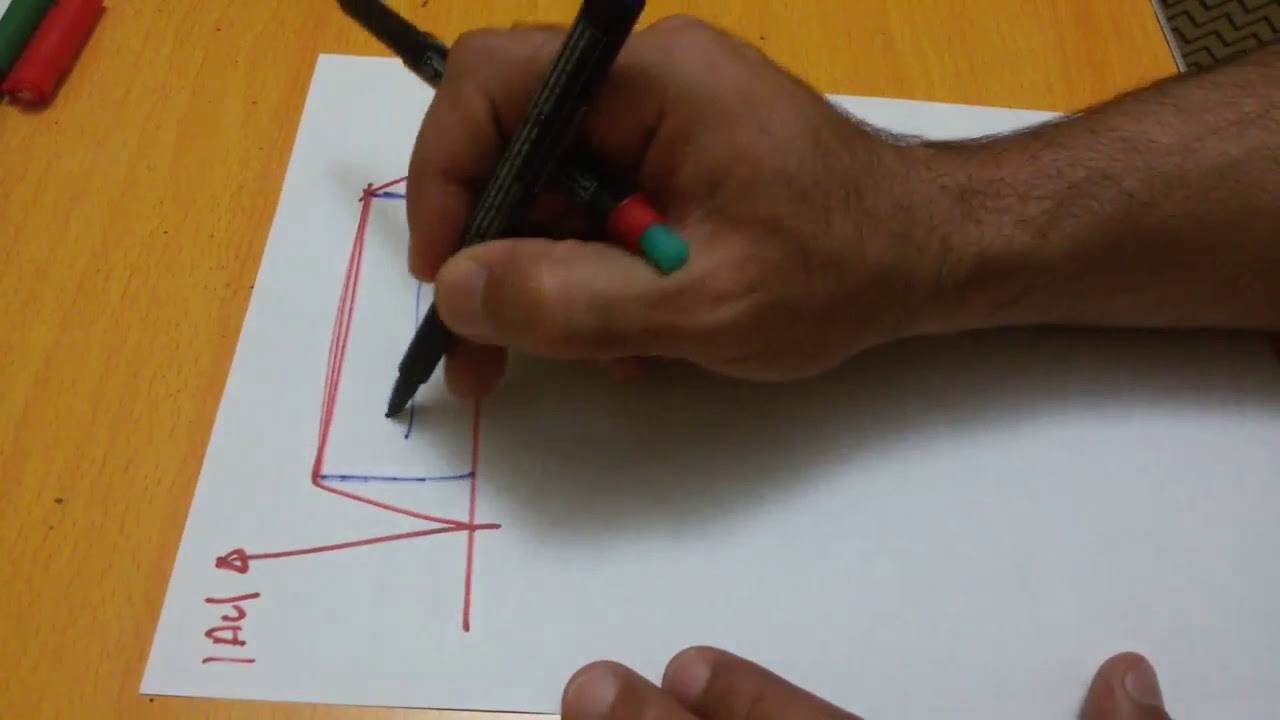 Transistor 24: Frequency response الاستجابة الترددية لدوائر المضخم