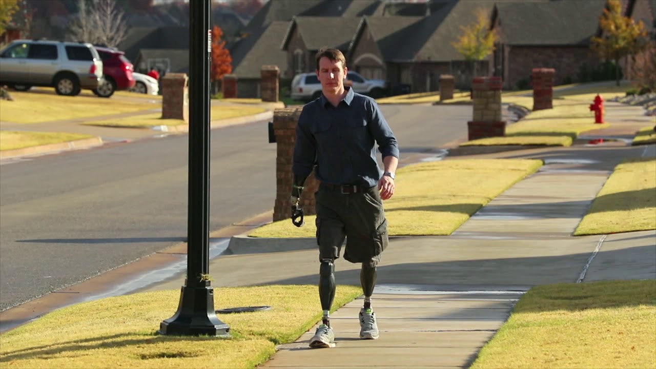 Show Your Heart - Dream Team Prosthetics Patients Success