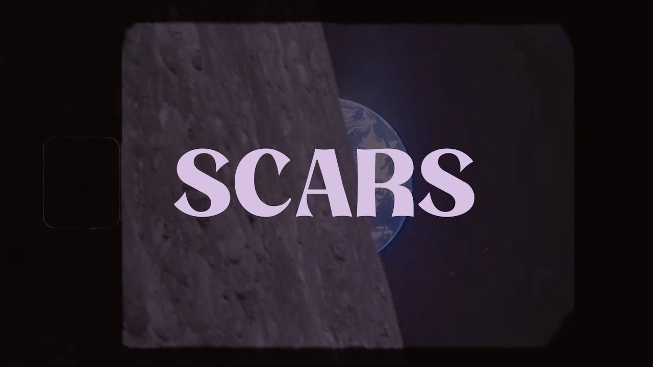 VINEDU - SCARS (PROD. ATLXTA x PRODBYFERM)