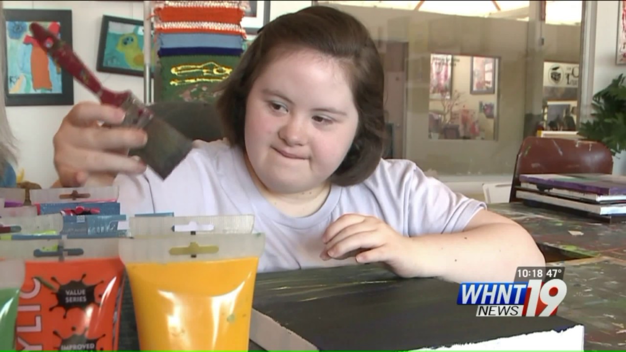 Alabama Artist with Special Needs is Getting a Lot of Attention Around the Country