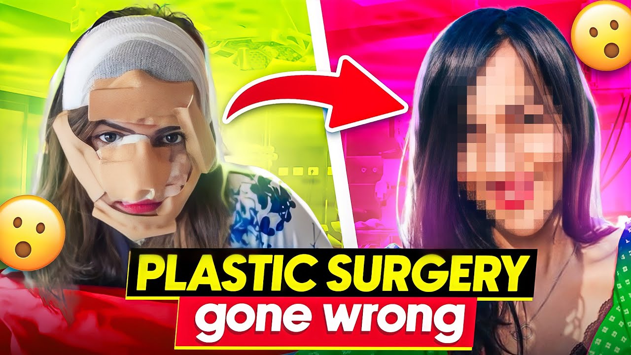 I got Plastic Surgery and Now I REGRET it 😱 (YE KYA KAR LIYA) ?