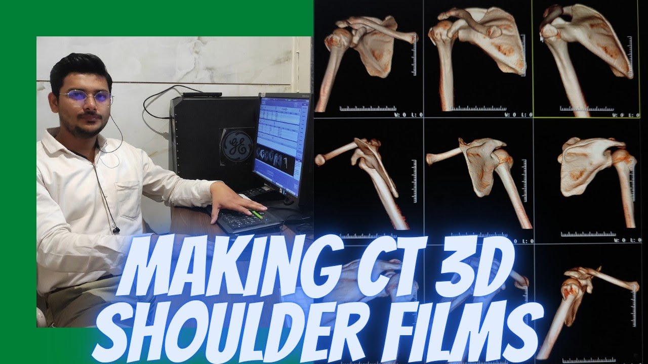 3D Shoulder CT Scan Filming Process and techniques #ctscan #gehealthcare  #radiologytechnologist