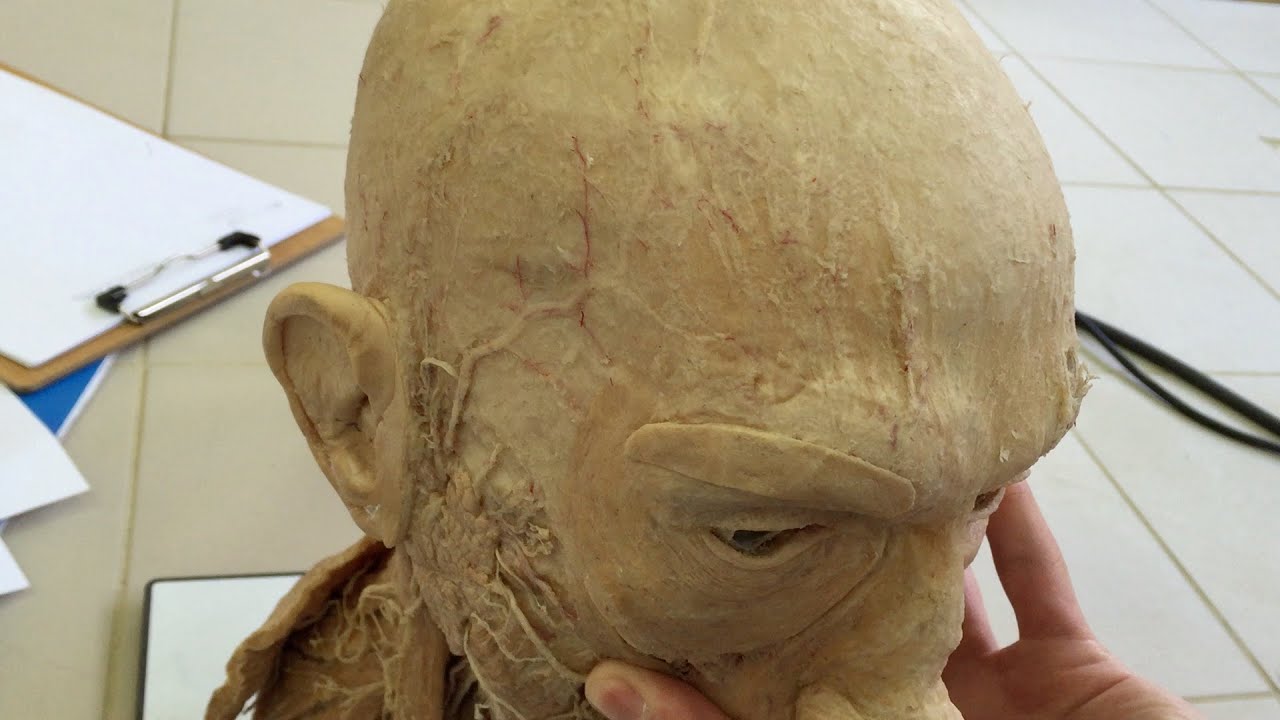 Anatomy of the Scalp (Subtitled)