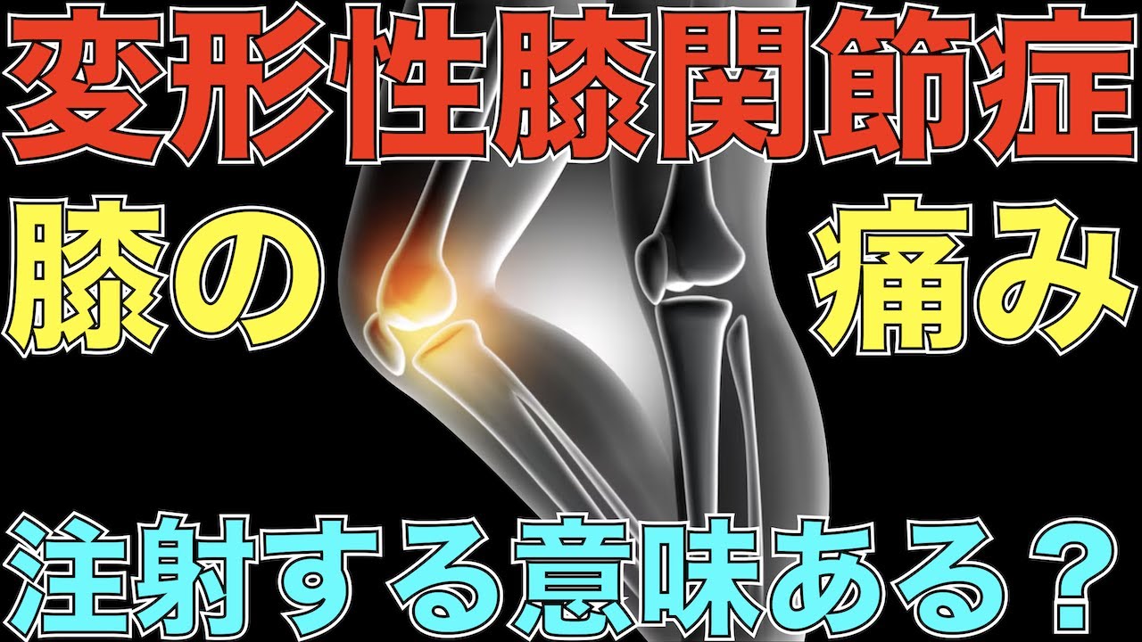 【変形性膝関節症】たった2回の施術で