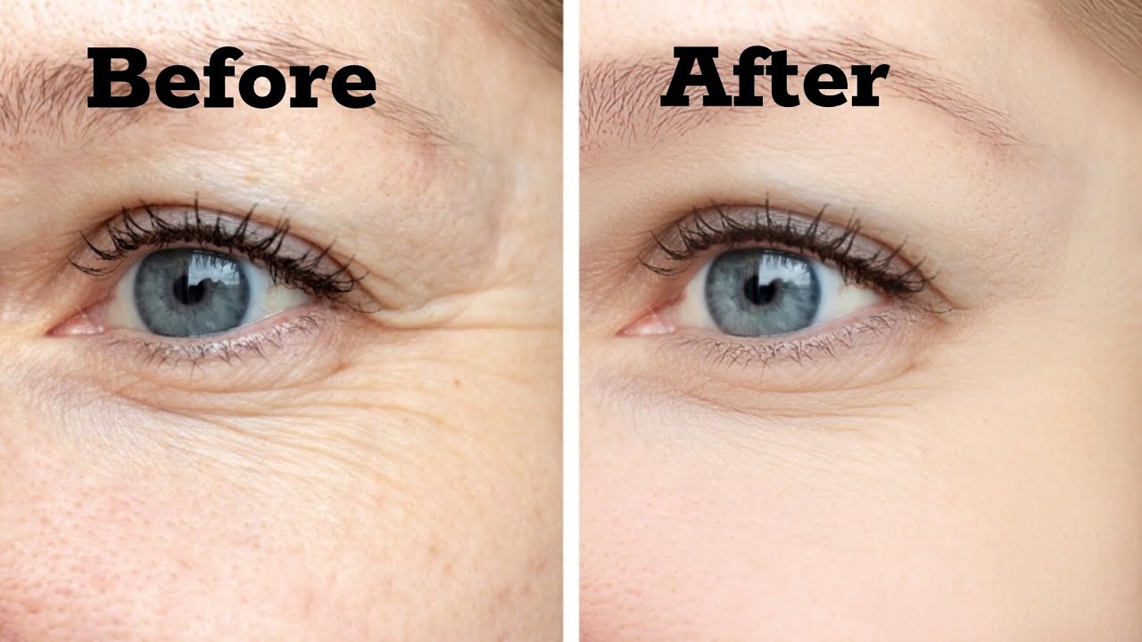 The anti aging skincare! The secret to plump skin. No Botox Use all over your body without worrying