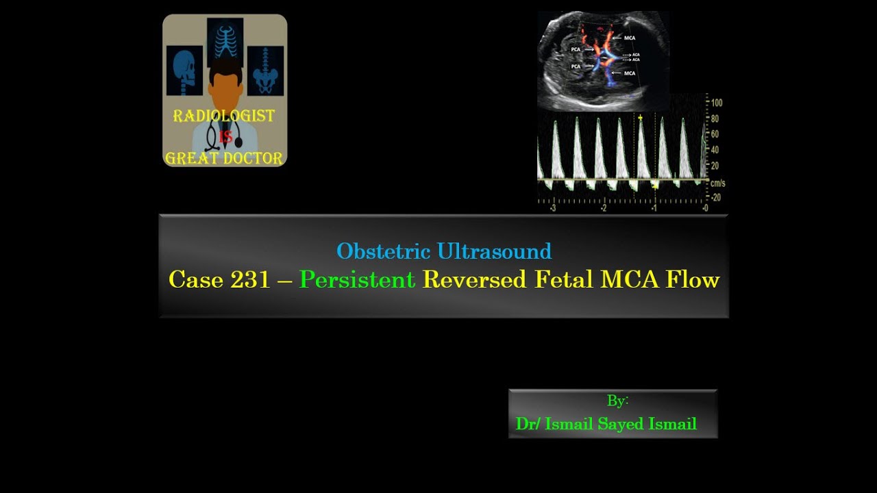 Ultrasound Case 231 - Persistent Reversed Fetal MCA Flow