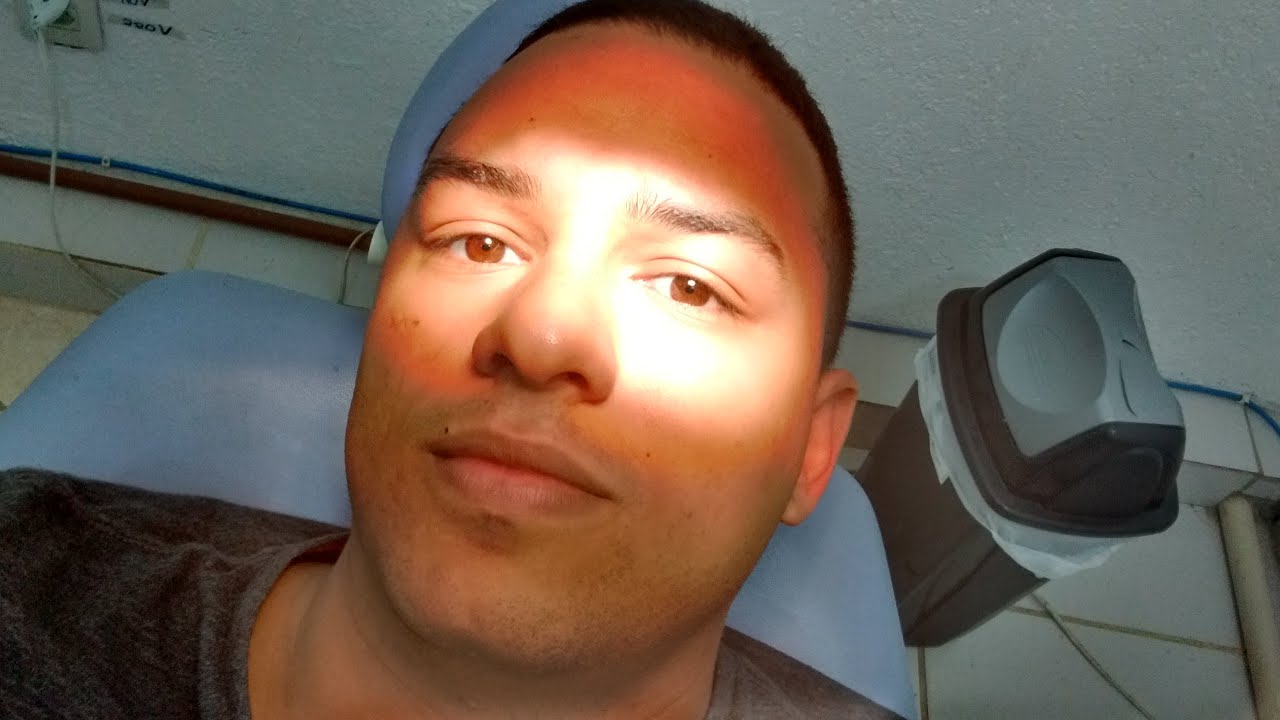 MEU CANAL NO DENTE / DIEGO BENNKER