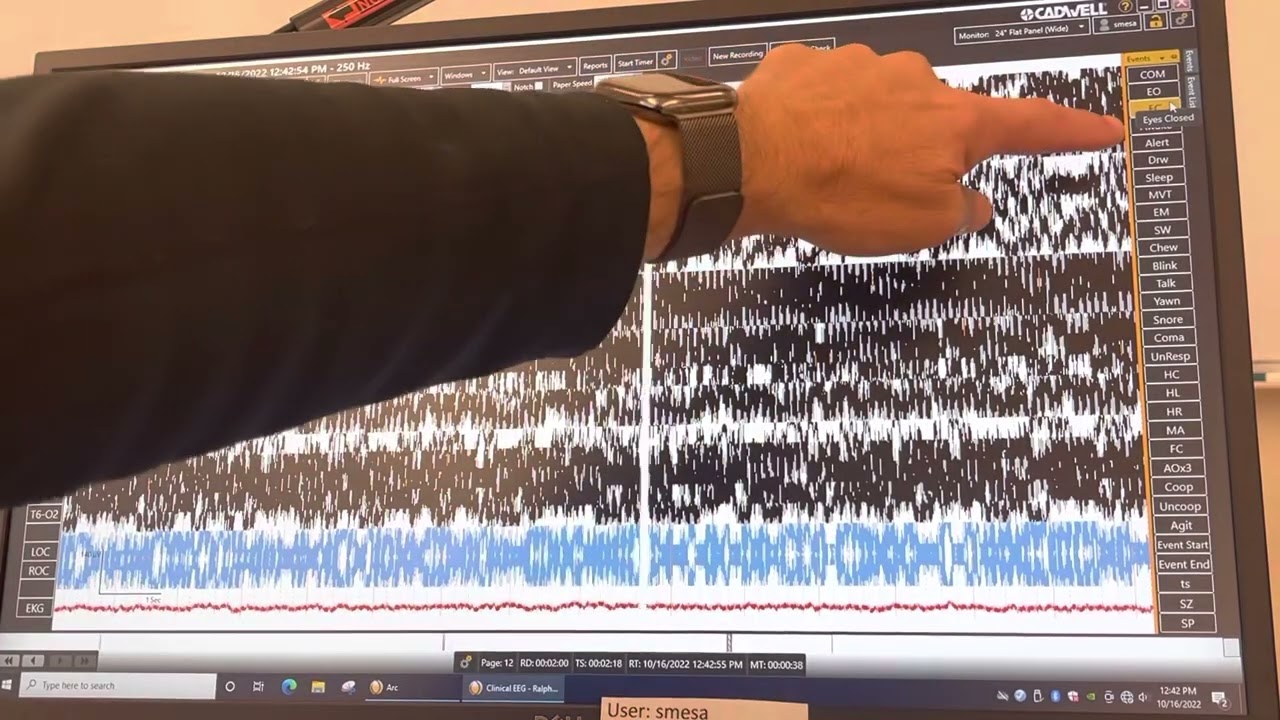 Cadwell: Starting a file and some basic recording functions.