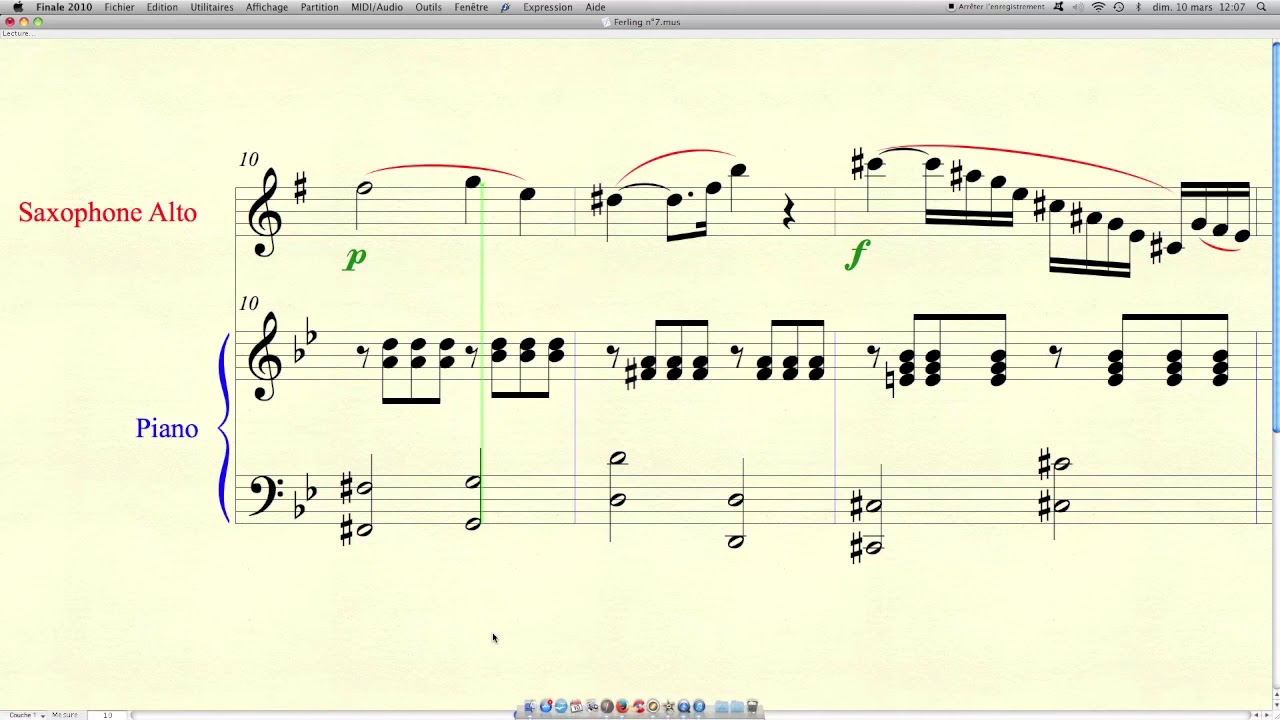 Projet FERLING Etude n°7