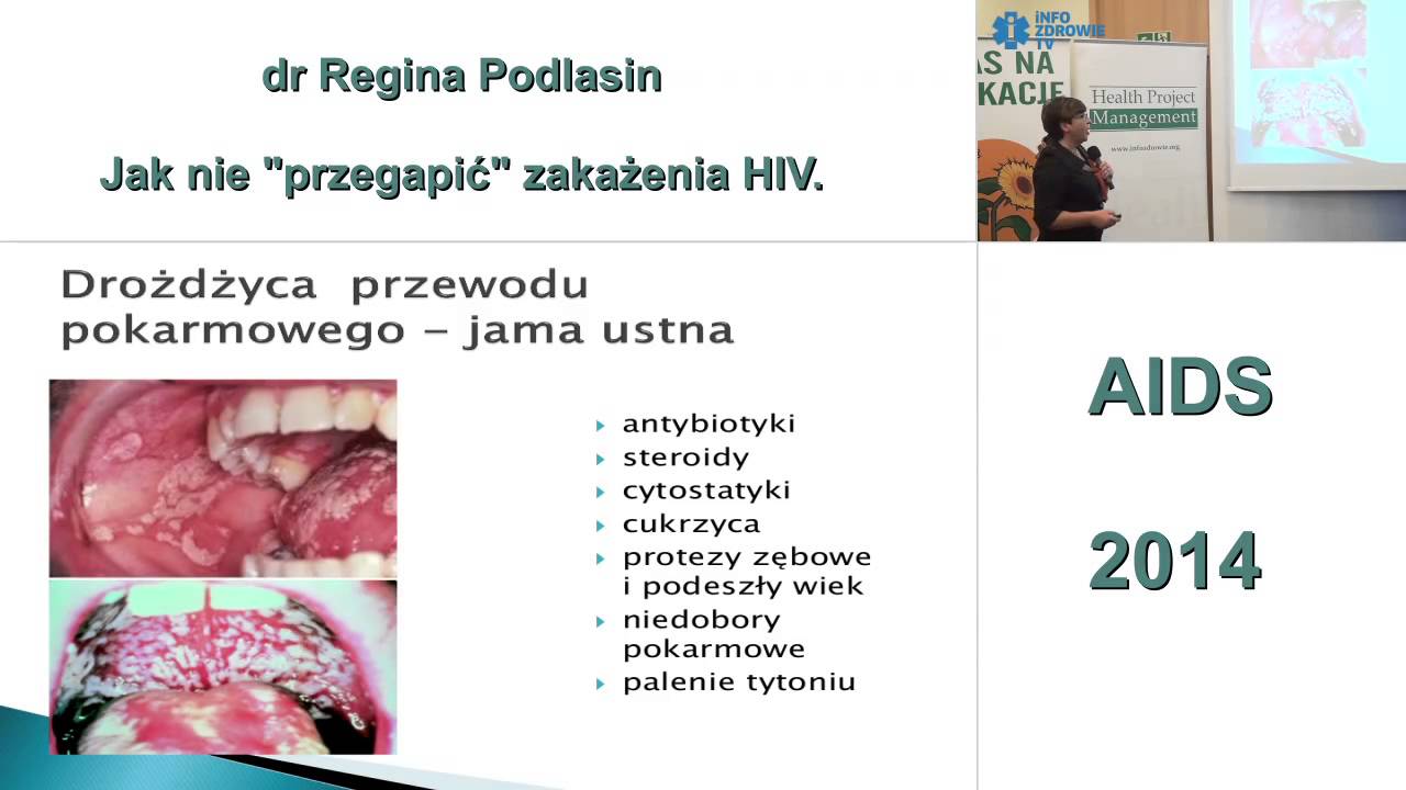 Jak nie “przegapić” zakażenia HIV