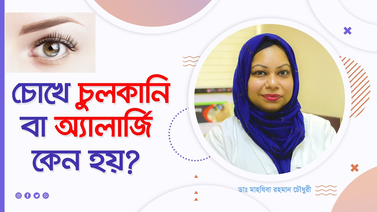 চোখের অ্যালার্জি ও চুলকানির সহজ সমাধান  | Allergic conjunctivitis: eye allergy cause & remedy.