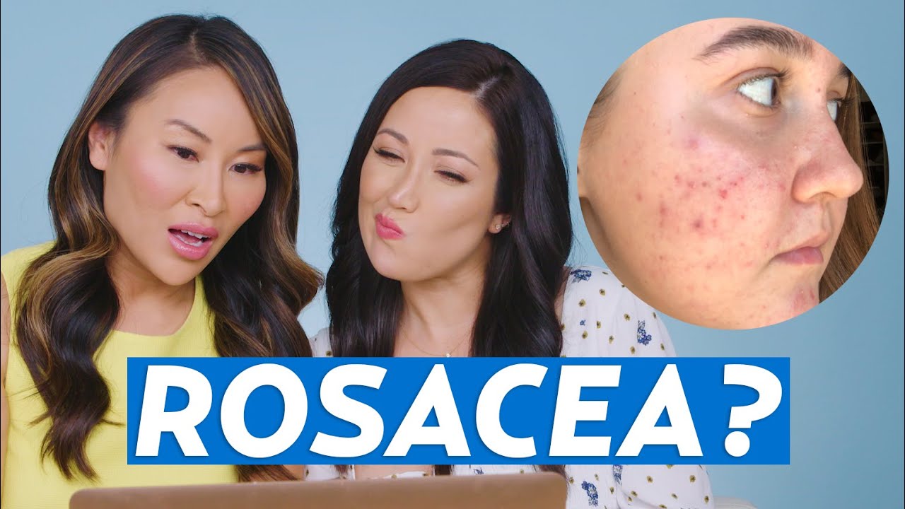 Acne Rosacea Skincare Routine for Anna! | #SKINCARE