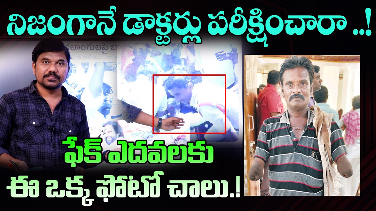 ఫేక్ ఎదవలకు ఈ ఒక్క ఫోటో చాలు.! Chandrababu Exposed Over Disability Pension Cheating | Velugu Tv