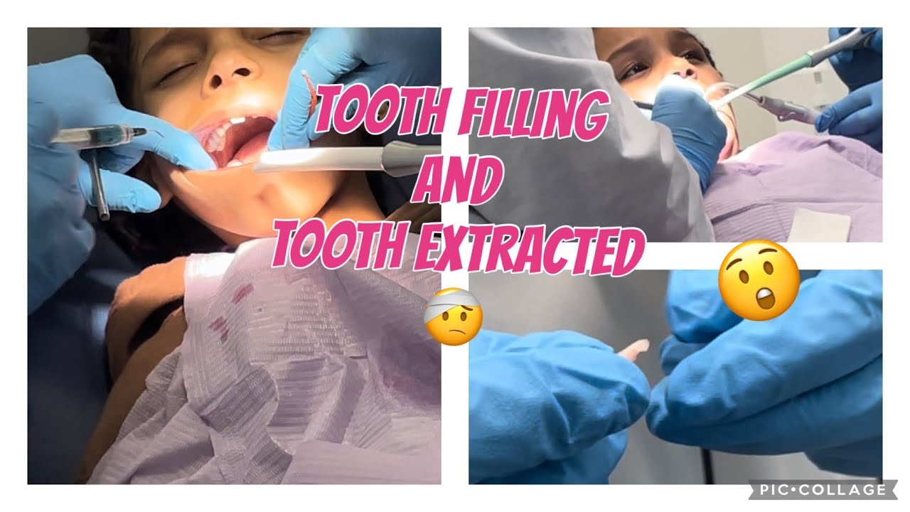 Karla and Kamila tooth filling and tooth extracted 😞 Vlog | Abreu Family