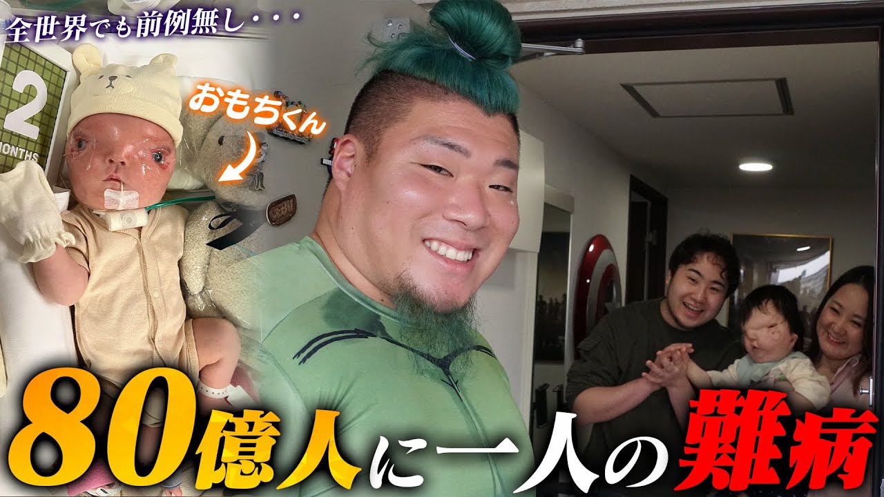 【80億人に1人】世界にも前例無し、病名すらない難病と闘うおもちくんに密着