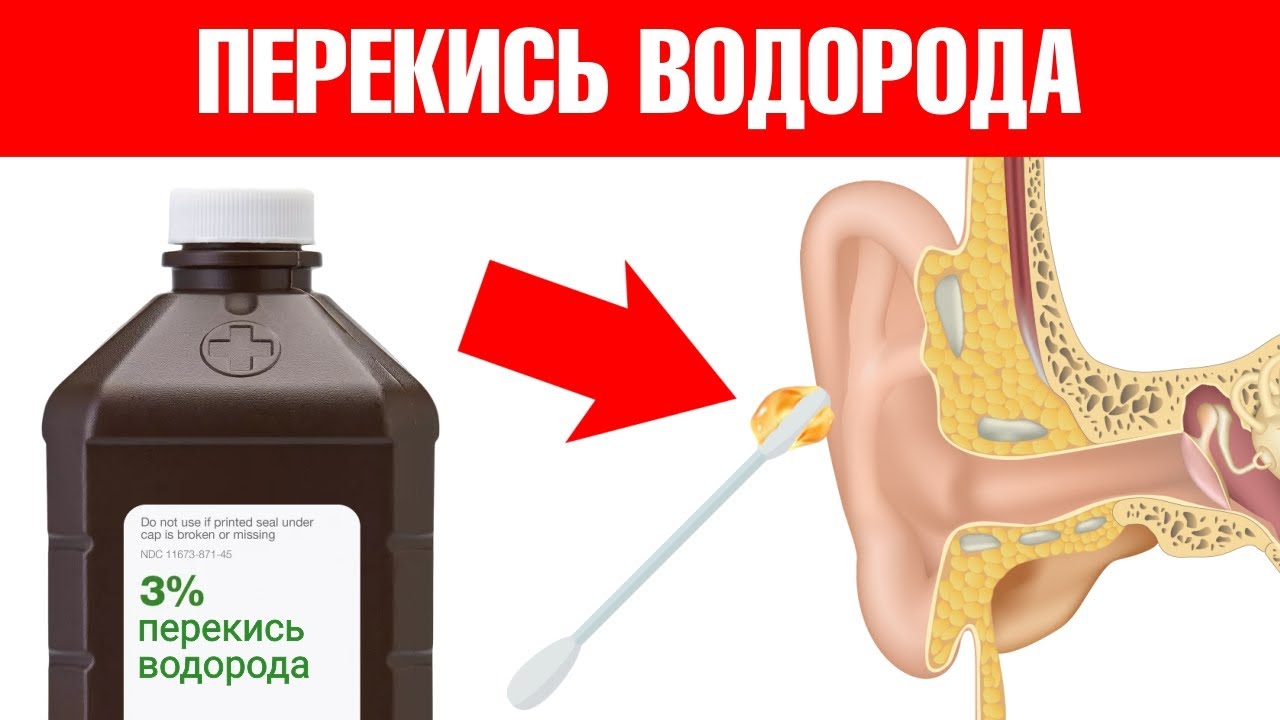 9 необычных способов применения перекиси водорода💥