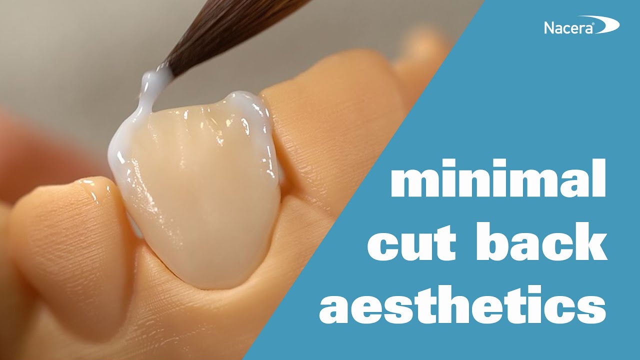 Nacera® Pearl Shaded: aesthetic procedure on zirconia crowns with cut back.