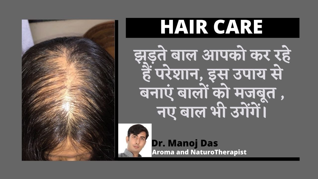 झड़ते बाल आपको कर रहे हैं परेशान, इस उपाय से बनाएं बालों को मजबूत , नए बाल भी उगेंगें। Dr. Manoj Das