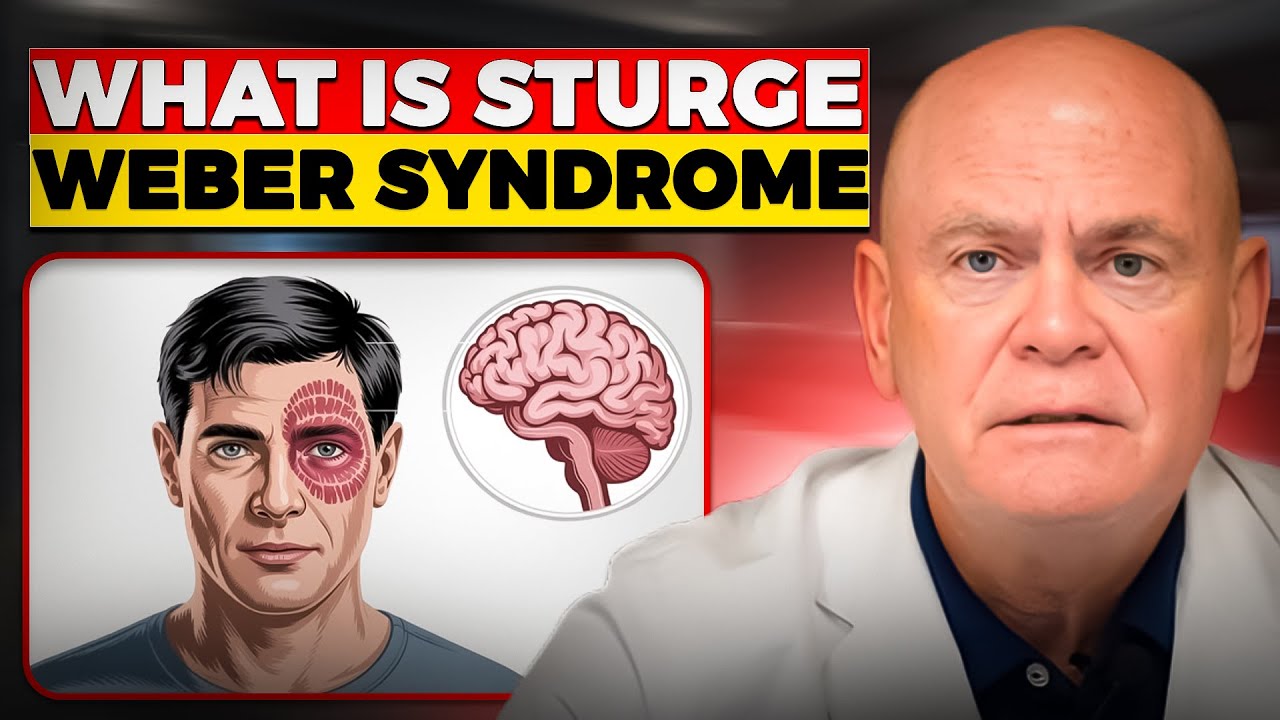 The Truth About Sturge Weber Syndrome and Brain Impact