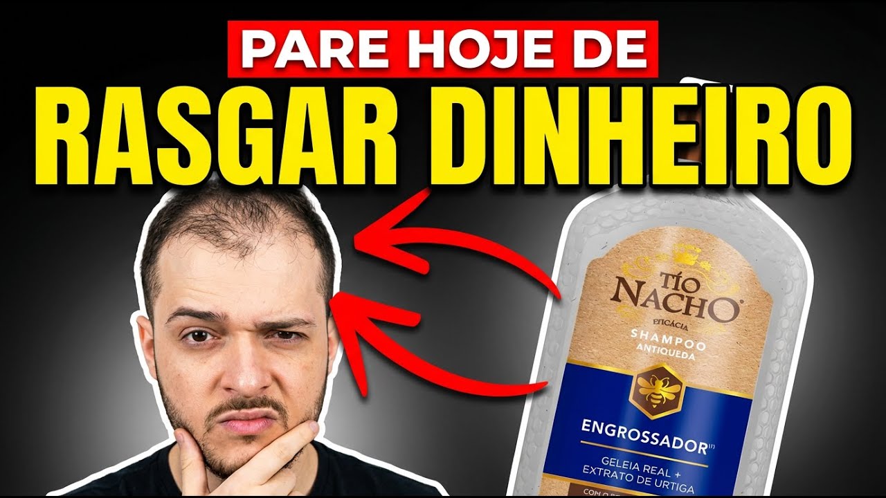 Shampoo Antiqueda Funciona Contra a Calvície? A VERDADE!