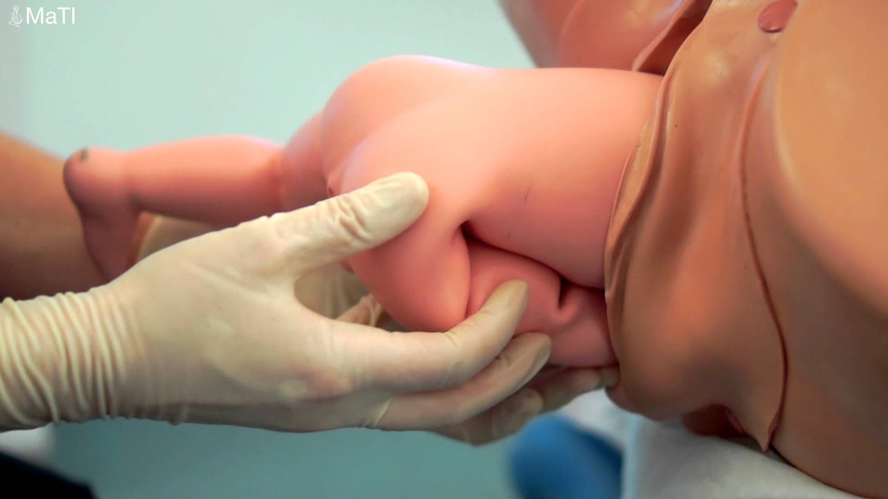 Vaginal Breech birth - all fours, unassisted, Bracht