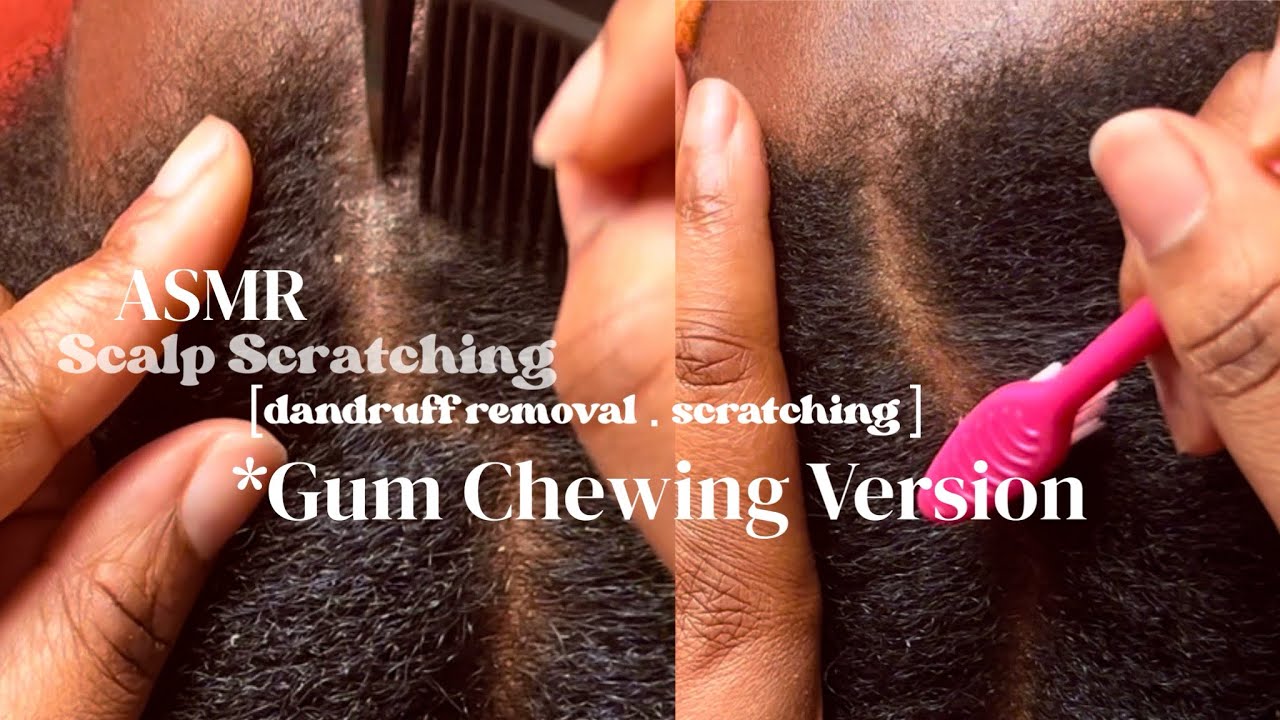 ASMR GUM CRACKING Scalp Scratching to Help You SLEEP